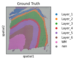 _images/T1_DLPFC_14_1.png