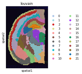 _images/T2_MouseBrain_18_0.png